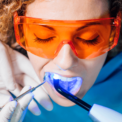 Kompositfüllungstherapie